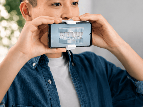 Dental Monitoring