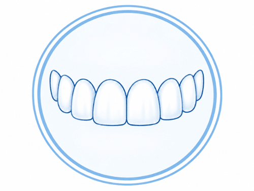 Illustration of straight, aligned upper teeth showcasing orthodontic alignment results