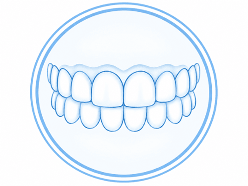 Illustration showing upper and lower teeth in proper bite alignment and occlusion