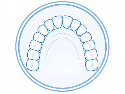 Illustration of upper dental arch showing smile width measurement for cosmetic planning